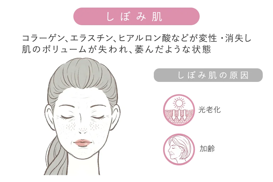 しぼみ肌（真皮層の弾力低下）