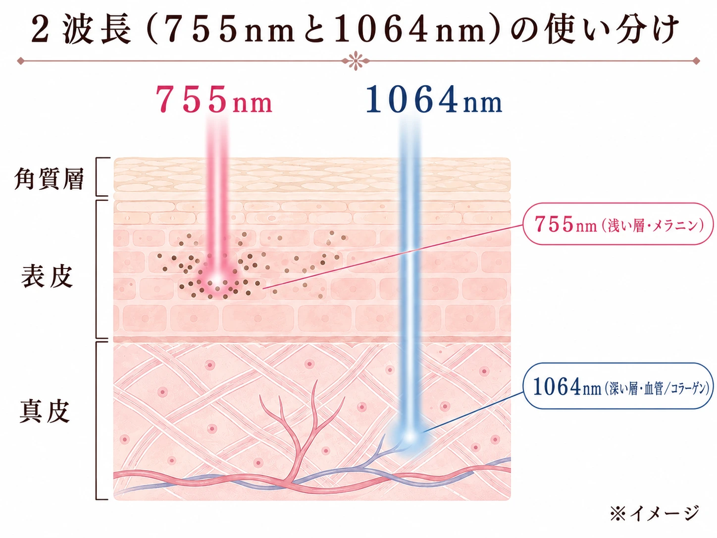 肌断面に755nmが浅い層・1064nmが深い層へ届く2本の光路を示した特徴イラスト