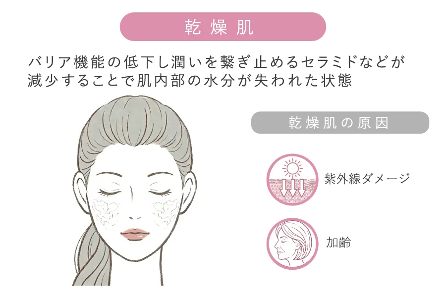 乾燥肌（バリア機能の低下）