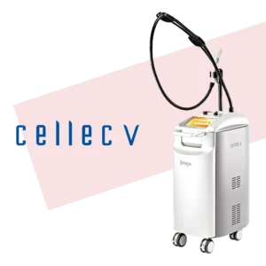 セレックV