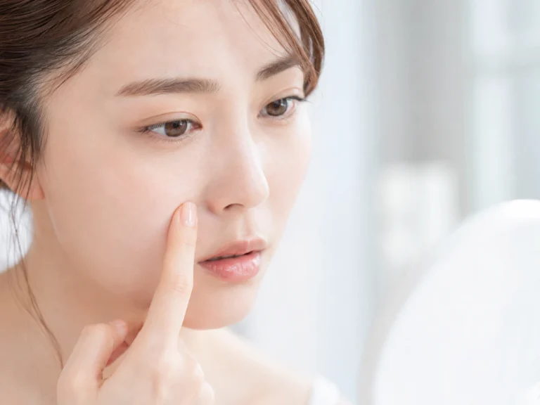 皮膚科医が解説。ニキビの正しいスキンケア。