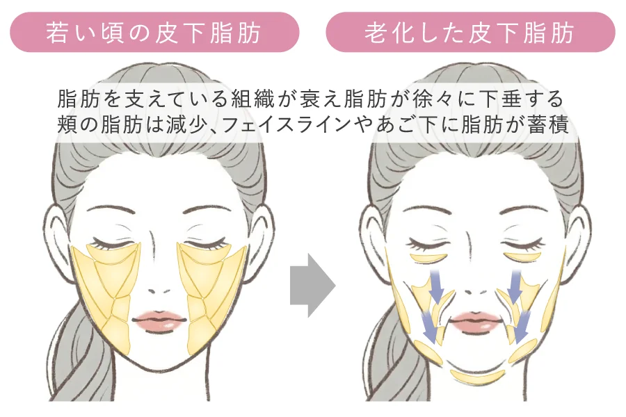 皮下脂肪の量の変化や下垂