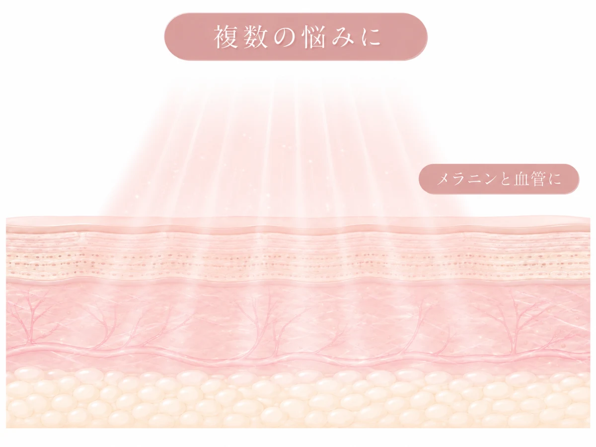 幅広い波長の光が肌断面のメラニンと毛細血管に同時に届くことを示したイメージイラスト