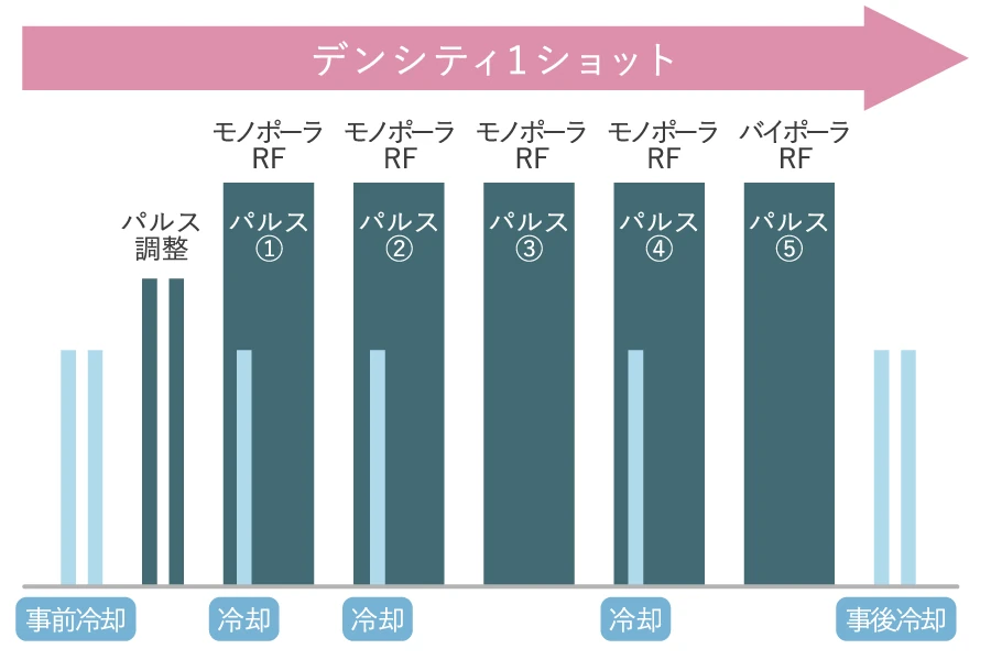 痛みを抑えるデンシティのガス冷却システムの図解