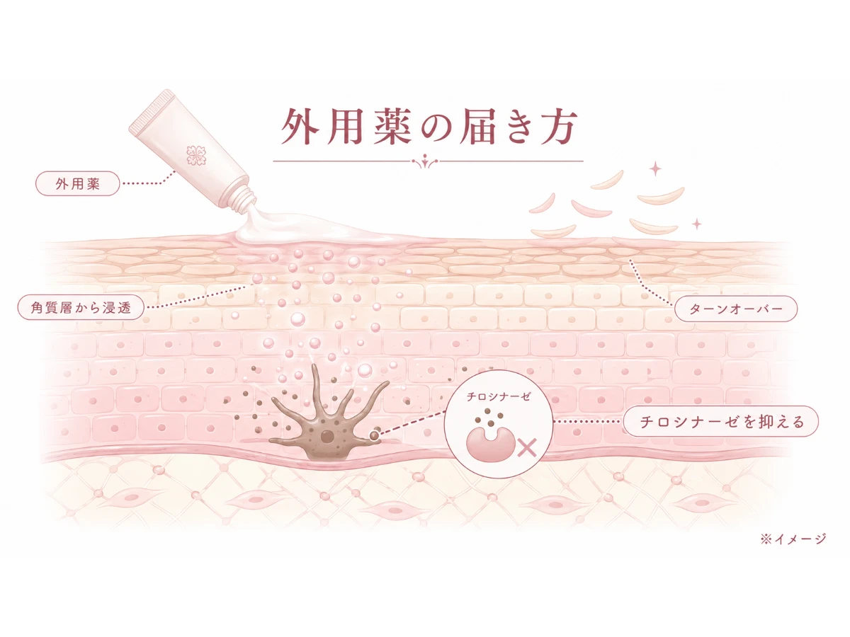 外用薬が角層から表皮・真皮へ作用しチロシナーゼを抑えターンオーバーを促す仕組みの解説図