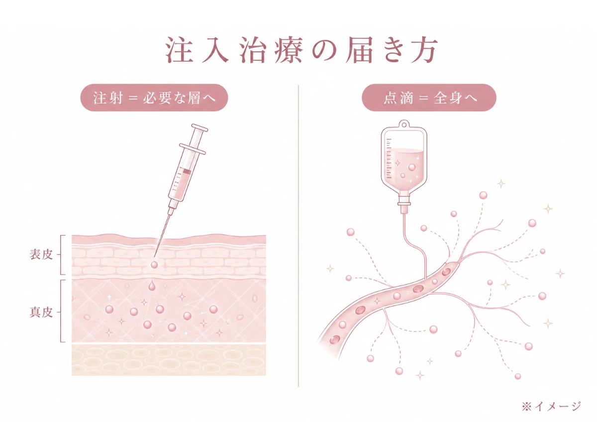 注射で薬剤・美容成分が肌の必要な層に、点滴で全身に届く考え方を示した解説図