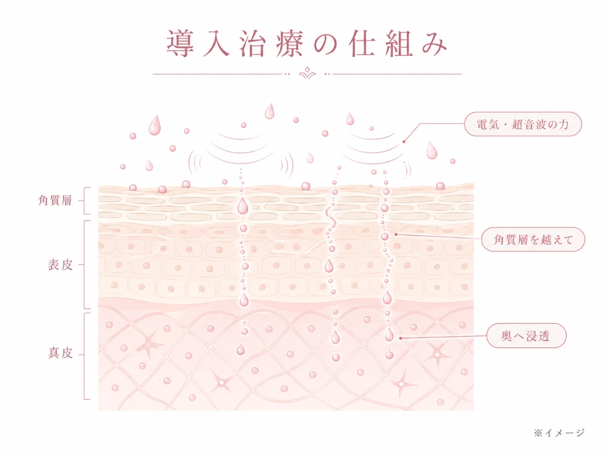 電気や超音波の力で美容成分が肌断面の角層を越えて奥へ浸透していく仕組みを示した解説図