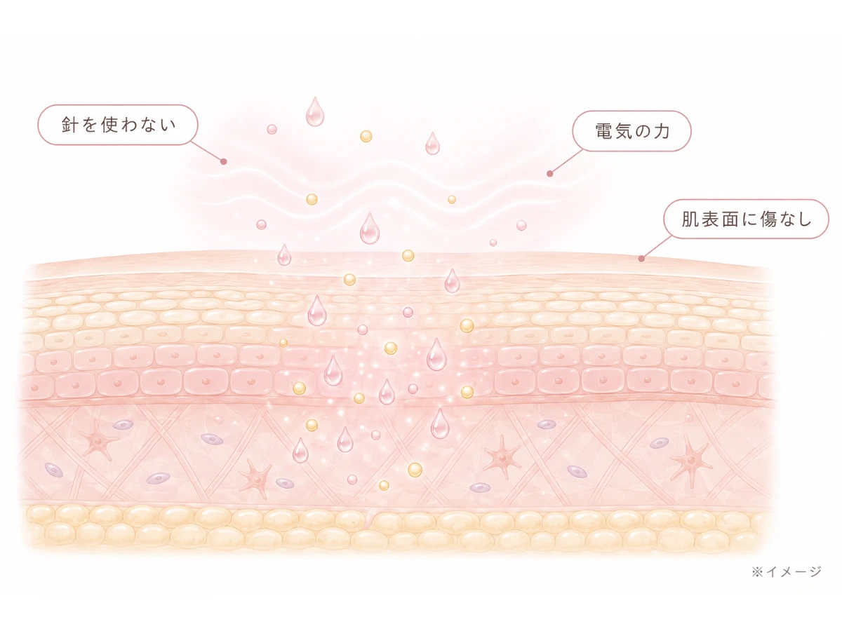 針を使わず美容成分が肌に入る様子を示した肌断面イラスト