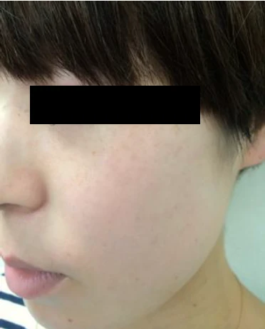After