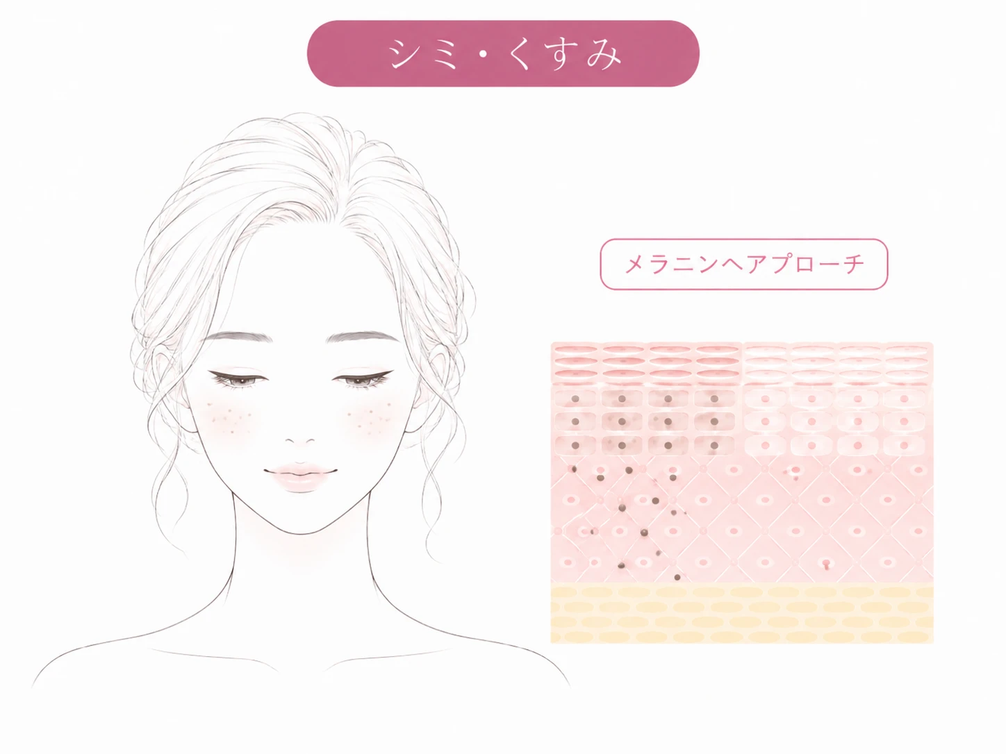 シミ・くすみのお悩みイメージイラスト