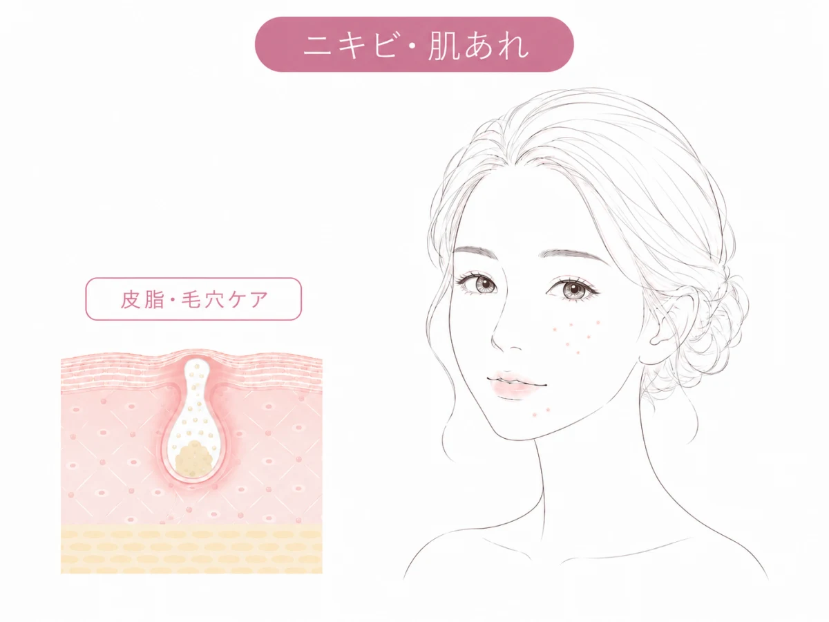 ニキビ・毛穴のお悩みのイメージイラスト