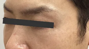 After