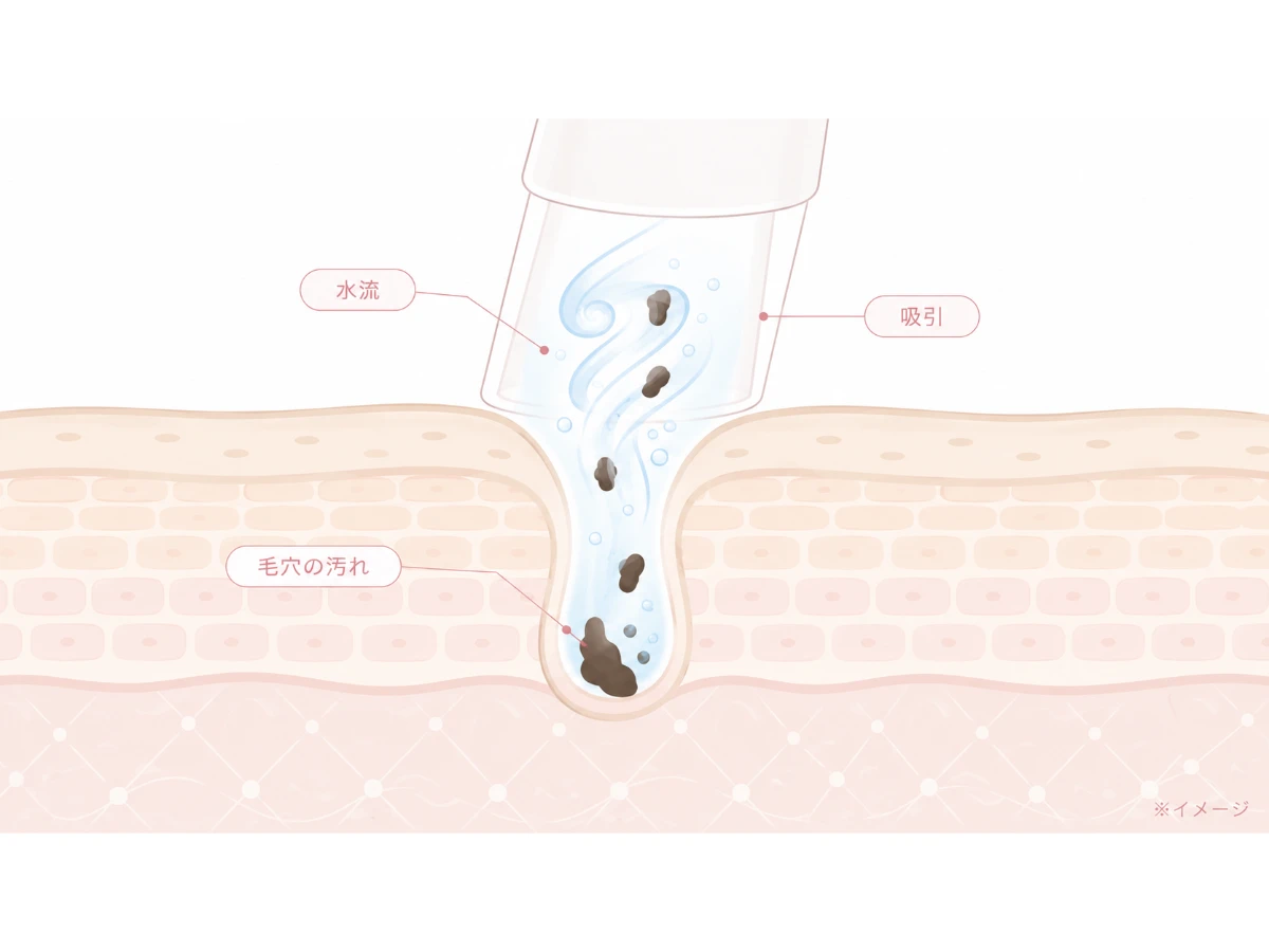 水流と吸引で毛穴の汚れを浮かせて取り除く様子を示した肌断面のイメージイラスト