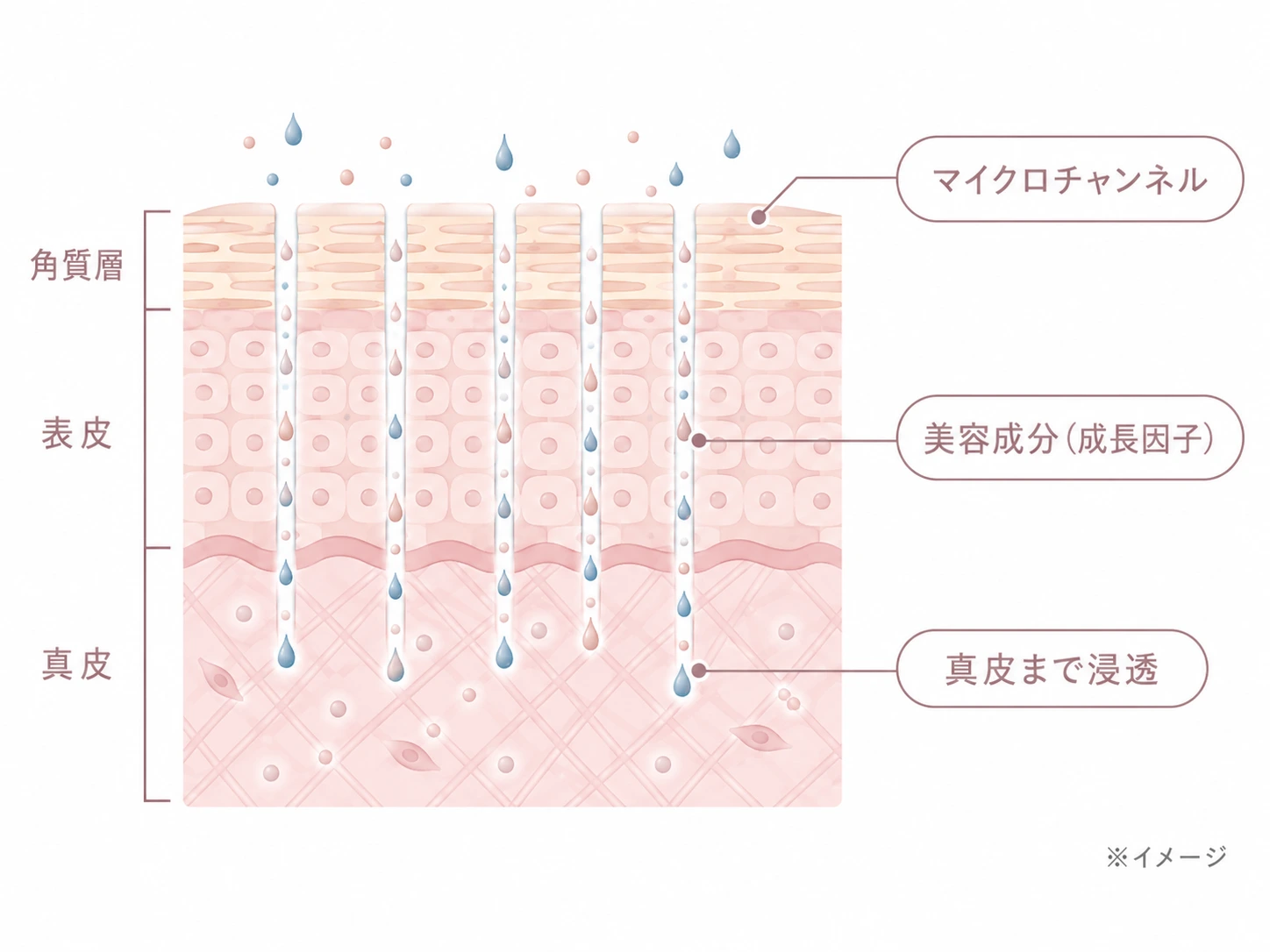 ダーマペン4で作ったマイクロチャンネルから美容成分（成長因子）が真皮まで浸透していく様子をラベル付きで示した断面解説図