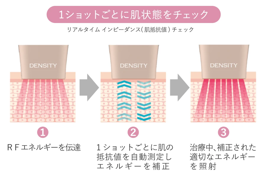 1ショットごとに肌の抵抗値を測定するRTIC機構の図解