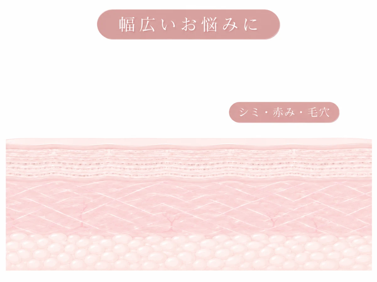 シミ・赤み・毛穴・脱毛など幅広い適応を示した肌断面のイメージイラスト