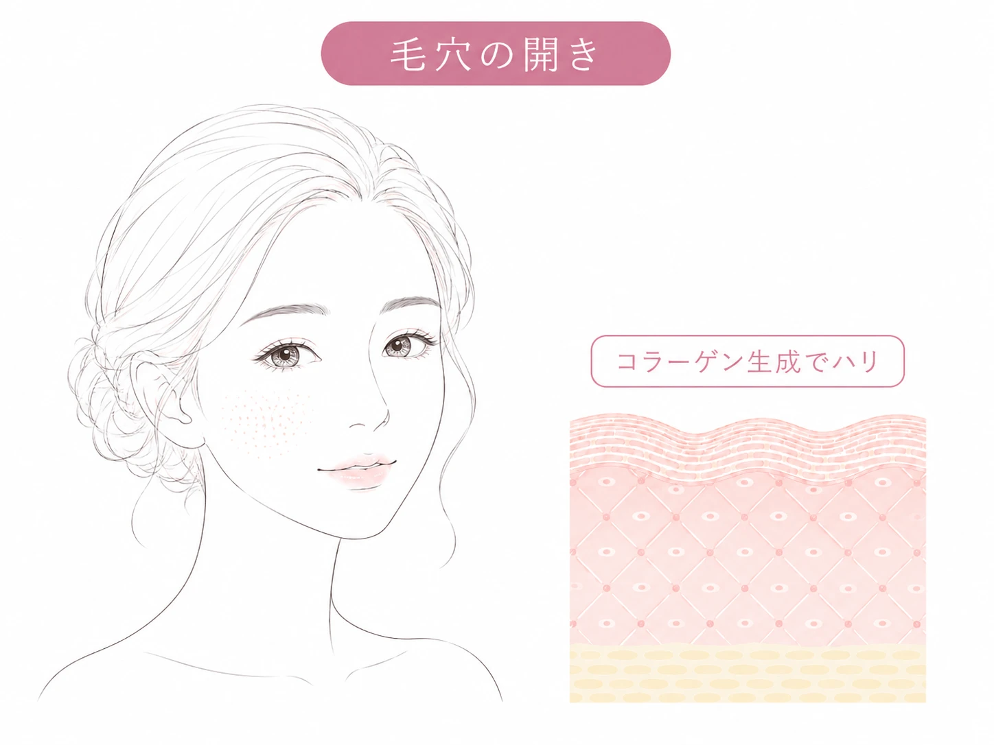 毛穴・肌質のお悩みイメージイラスト