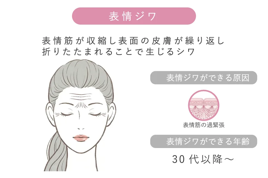 表情筋の動きによる表情ジワ