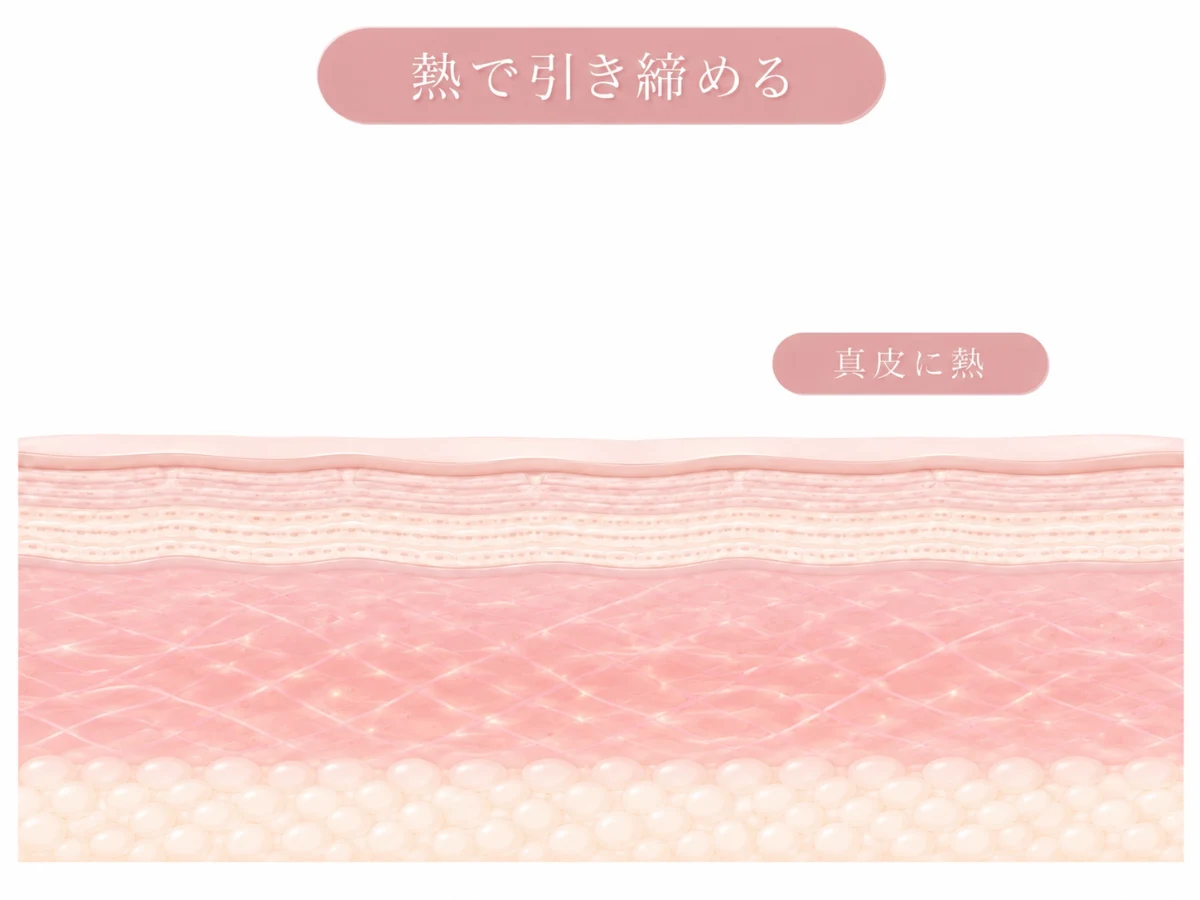 高周波の熱で肌が引き締まる様子を示した肌断面のイメージイラスト
