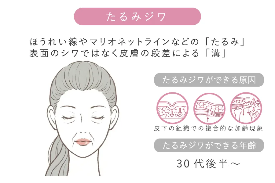 皮膚の段差によるたるみジワ