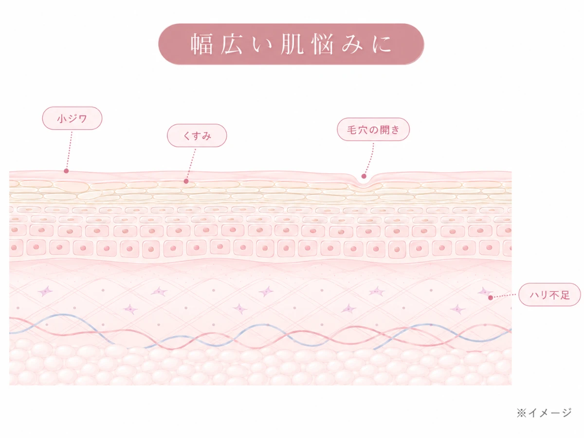 小ジワ・くすみ・毛穴の開き・ハリ不足など複数の肌悩みに対応することを示した肌断面のイメージイラスト