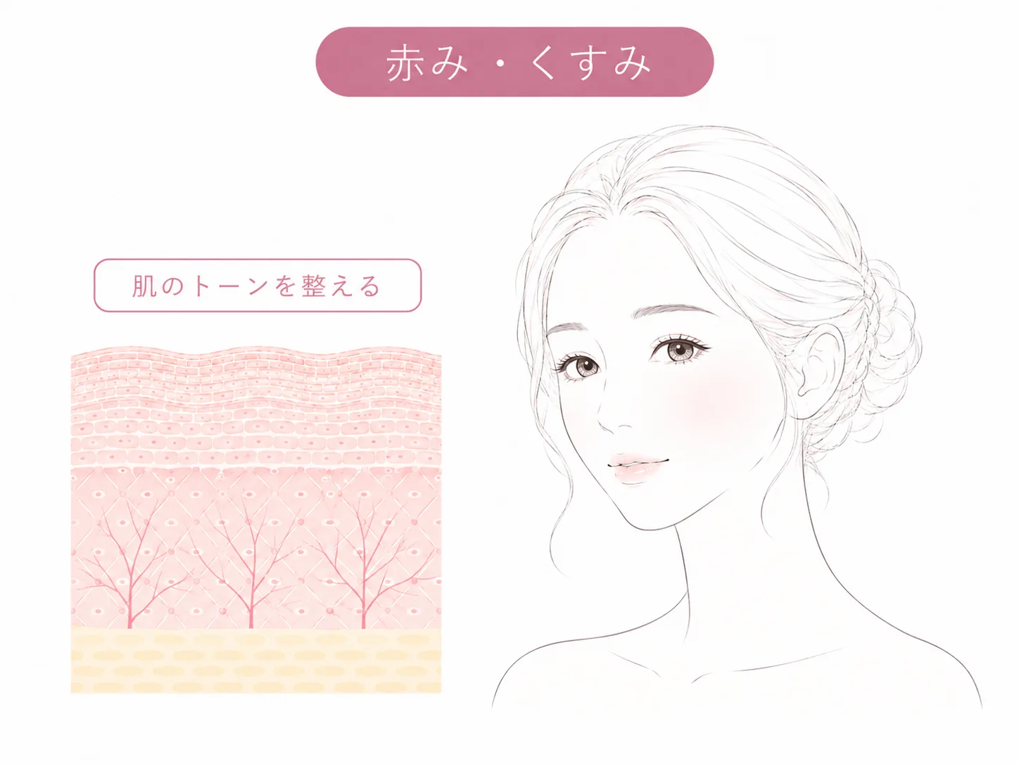 肌の赤み・くすみのお悩みイメージイラスト