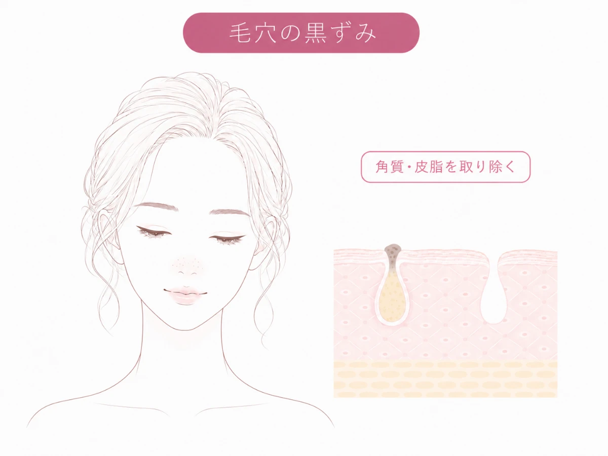 毛穴に古い角質と皮脂が詰まって黒ずんだ状態と、取り除かれてなめらかに整った状態を並べて示した肌断面のイメージイラスト