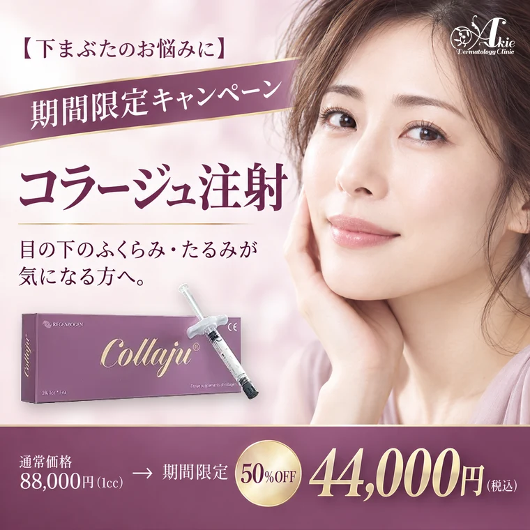 コラージュ注射 期間限定50%OFF（下まぶたのお悩みに）